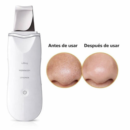 UltraScrub - Espátula Ultrasónica Facial