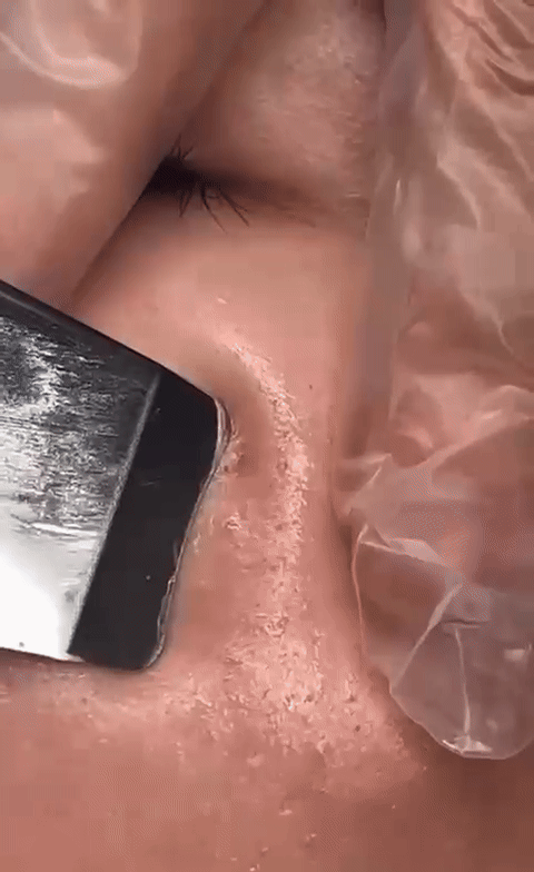 UltraScrub - Espátula Ultrasónica Facial