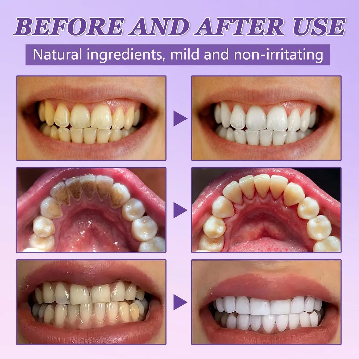 POLVO REPARADOR DENTAL🦷✨